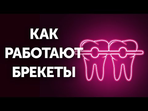 Видео: Как работают брекеты (и почему так медленно)