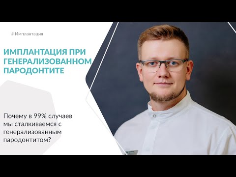 Видео: Имплантация при генерализованном пародонтите.