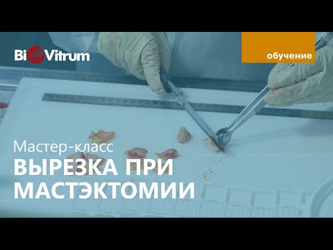 Видео: Вырезка после мастэктомии