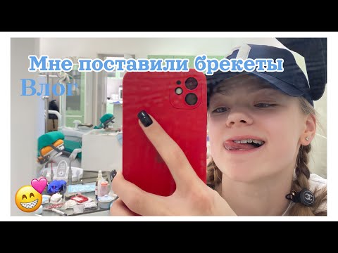 Видео: Мне поставили брекеты// НАКОНЕЦ-ТО 💗💗влог