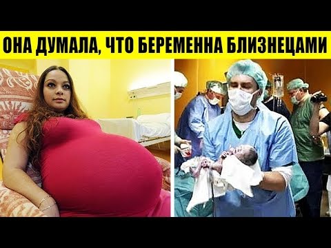 Видео: 6 МАТЕРЕЙ, У КОТОРЫХ РОДЫ ПОШЛИ НЕ ПО ПЛАНУ