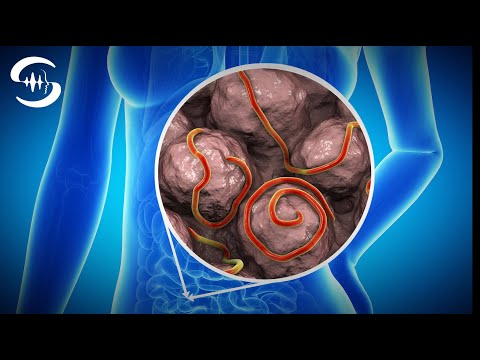 Видео: Частота червей и частота очищения от паразитов (музыкальная терапия 128 Гц)