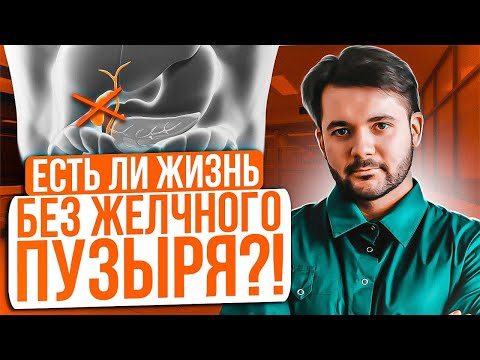 Видео: КАК ЛЕГКО ЖИТЬ ПОСЛЕ УДАЛЕНИЯ ЖЕЛЧНОГО ПУЗЫРЯ. Самые эффективные рекомендации