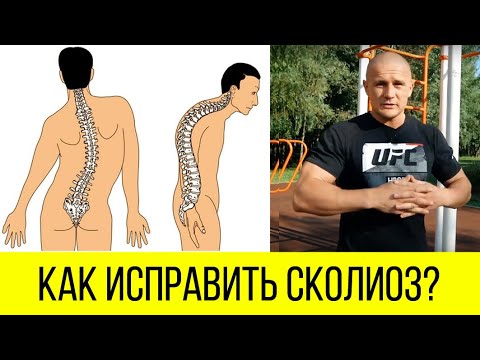 Видео: Как исправить сколиоз. [Комплекс упражнений]. Михаил Яцык
