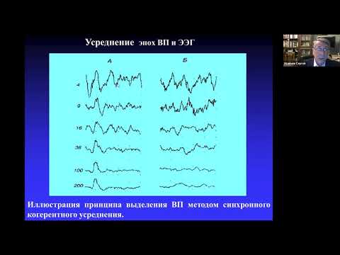 Видео: Вызванные потенциалы мозга