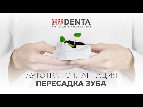 Видео: Сам себе донор: аутотрансплантация зуба