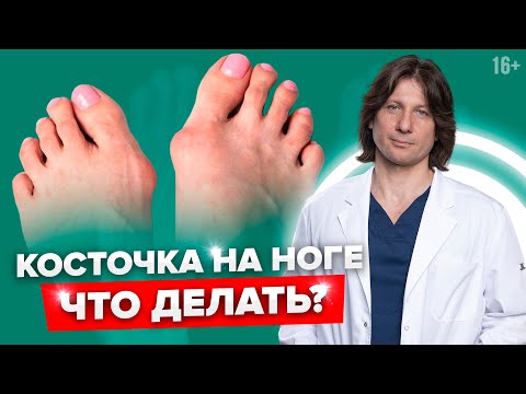 Видео: 4 упражнения, чтобы избавиться от косточки на ноге у большого пальца.