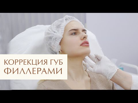 Видео: 👄 Как делается контурная пластика губ? Процесс и результат. Как делается контурная пластика губ. 12+