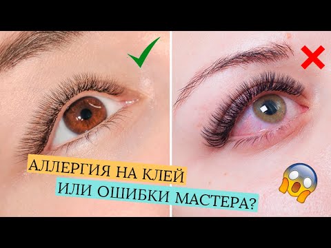 Видео: КРАСНЫЕ ГЛАЗА ПОСЛЕ НАРАЩИВАНИЯ РЕСНИЦ!  ВСЕ ПРИЧИНЫ И КАК ИЗБЕЖАТЬ?