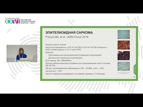 Видео: Лекарственное лечение редких подтипов сарком