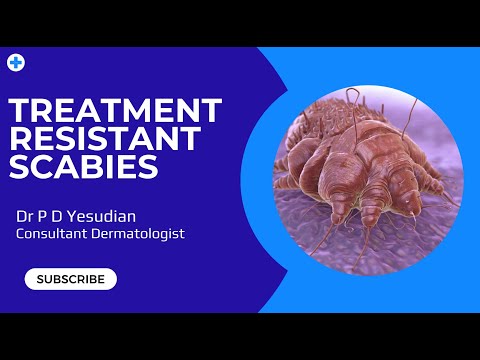 Видео: Как лечить чесотку