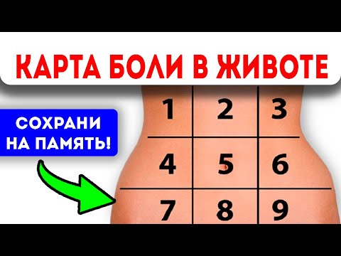 Видео: Вот как БЫСТРО УЗНАТЬ, почему у Вас БОЛИТ ЖИВОТ! Карта боли в животе
