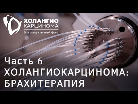 Видео: ЧАСТЬ 6. ХОЛАНГИОКАРЦИНОМА: БРАХИТЕРАПИЯ // МАЛОИНВАЗИВНЫЕ МЕТОДЫ ПРОТИВООПУХОЛЕВОГО ЛЕЧЕНИЯ