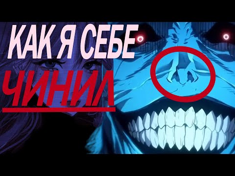 Видео: КАК Я СЕБЕ НОС ЧИНИЛ | СЕПТОПЛАСТИКА