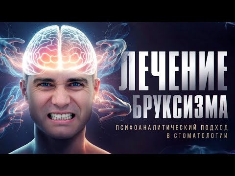 Видео: Бруксизм. Причины. Виды. Симптомы. Комплексное лечение. Видео 20.  Манифест Нового Человека. 