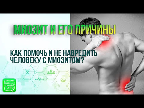Видео: Миозит и его причины | Как помочь человеку с миозитом?