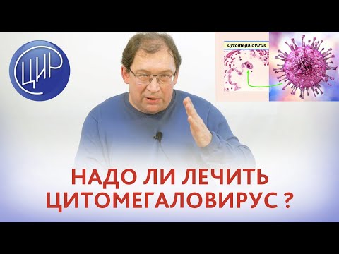 Видео: TORCH-инфекции Надо ли лечить антитела. Цитомегаловирус. Гузов И.И.