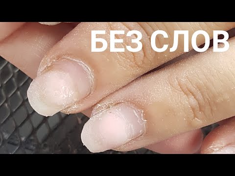 Видео: Очень короткие ногти/Шулунова Дарья