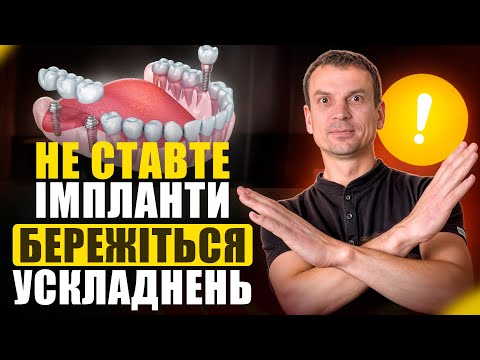 Видео: Кому НЕ МОЖНА ставити Імпланти? Стоматологи МОВЧАТЬ про це!