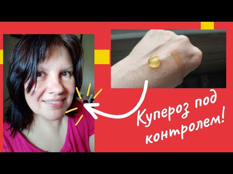 Видео: Нет Купероза на лице! Мой опыт борьбы с куперозом. Аптечные средства от расширенных сосудов на лице.