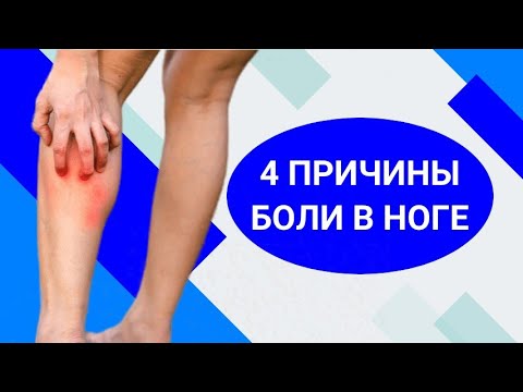 Видео: 4 ПРИЧИНЫ БОЛИ В НОГАХ: почему болят ноги?