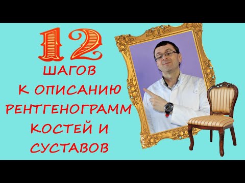 Видео: ОПИСАНИЕ РЕНТГЕНОГРАММ КОСТЕЙ И СУСТАВОВ