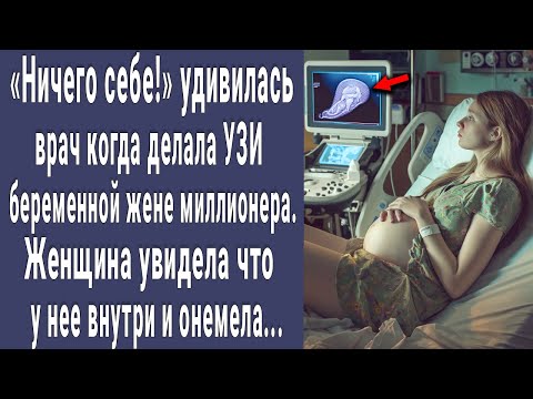 Видео: Ничего себе! удивилась врач на УЗИ беременной пациентке. Женщина увидела снимок и побледнела...