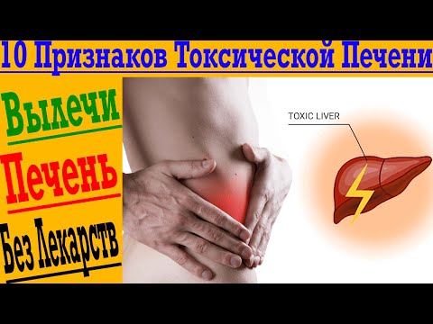 Видео: Как восстановить печень? Важные 10 признаков токсической печени!