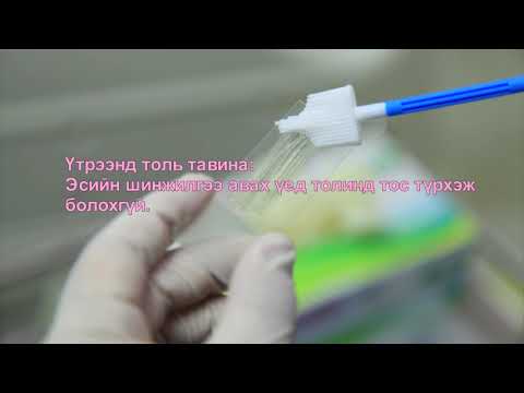 Видео: ЭБЭ Умайн хүзүүний эсийн шинжилгээ авах арга