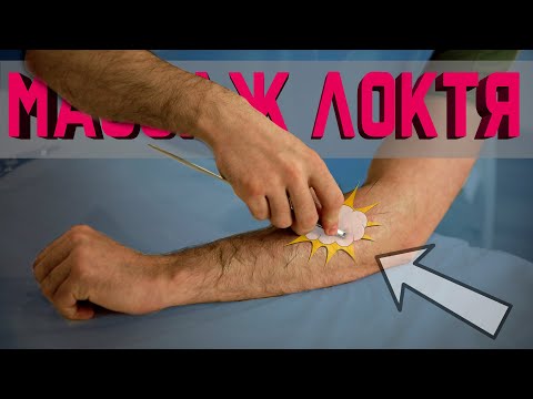 Видео: Самомассаж против локтя гольфиста и локтя теннисиста!