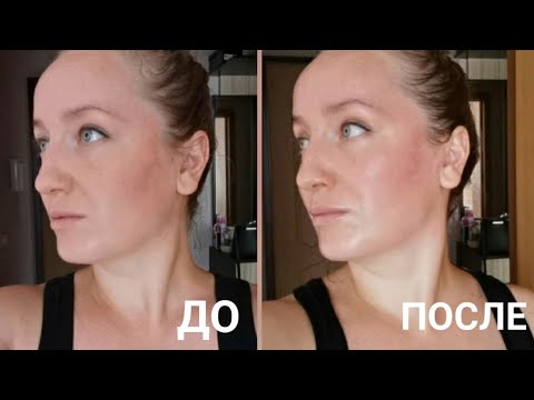 Видео: Массаж ГУАША. Мгновенный результат. Овал лица подтягивается после первой процедуры 🤩