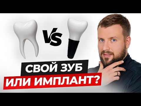 Видео: Удалять или лечить зуб? Важный совет!