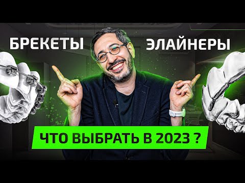 Видео: Брекеты или Элайнеры — что лучше в 2023 году? Плюсы и Минусы