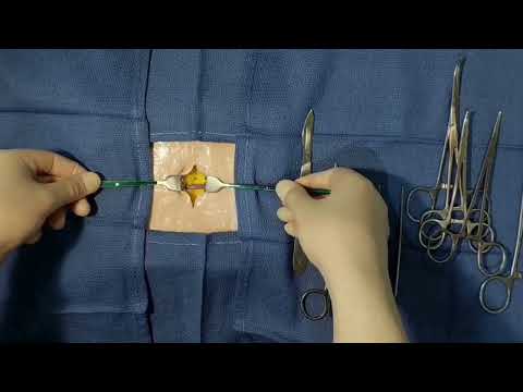 Видео: Венесекція