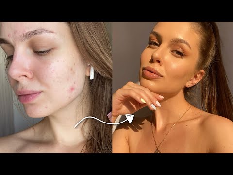 Видео: ОШИБКИ В УХОДЕ | УХОД ЗА ЖИРНОЙ, КОМБИ И ПРОБЛЕМНОЙ КОЖЕЙ