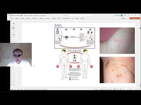 Видео: протозойные инвазии (лекция #1 цикла НМО "Паразитарные болезни")