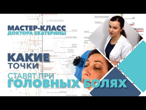 Видео: Ставим правильно! Рецепты точек акупунктуры при головных болях. Мастер-класс доктора Екатерины.