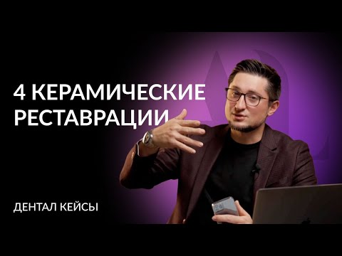 Видео: Артур Лукьяненко | Дентал Кейсы | 4 керамические реставрации