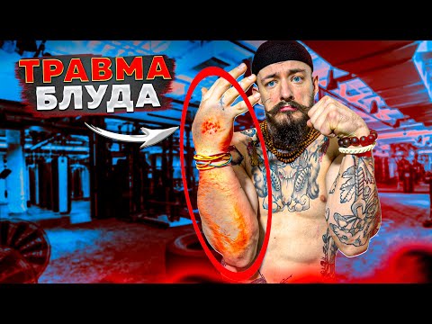 Видео: ТРАВМА ВИКТОРА БЛУДА