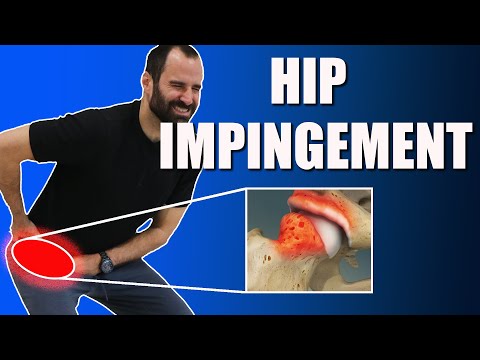 Видео: Облегчение боли при импинджменте тазобедренного сустава: перестаньте растягиваться и начните укре...