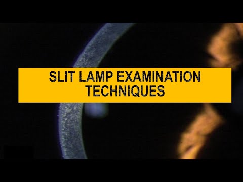 Видео: Диффузный против фокального | Оптический разрез, параллельная труба, коническое освещение — метод...