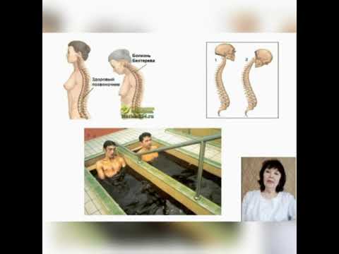 Видео: Тақырыбы: Бехтерев ауруы. Мейіргерлік үрдісті ұйымдастыру. Оқытушы: Конирова С.К.