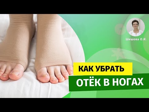 Видео: Как убрать отёк в ногах. [Шишова О.И.]