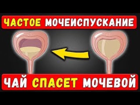 Видео: ПЕРЕСТАЛ бегать по ночам! Почему вы всё ещё мучаетесь  Узнайте о простом средстве ПРЯМО СЕЙЧАС!