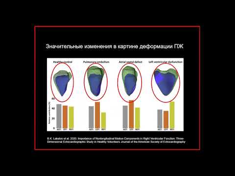 Видео: Эхокардиография (структурно-функциональная оценка) правых камер сердца