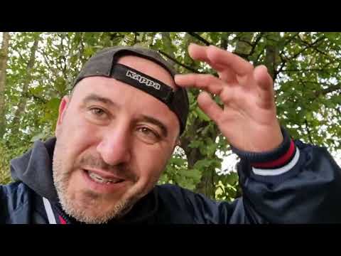 Видео: Косопад !!! Трансплантация на Коса !! Присаждане на Коса !!!