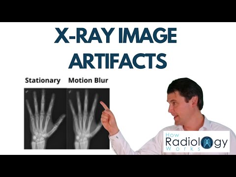 Видео: Артефакты рентгеновских изображений