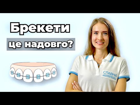 Видео: Хочу брекети. Це надовго?😱