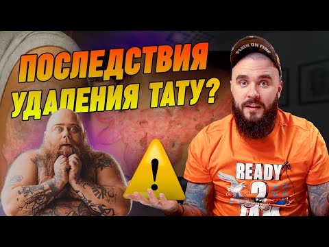 Видео: Этот кошмар может остаться на вашем теле навсегда! Ужасные последствия неправильного удаления тату!