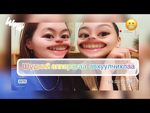 Видео: #Шүдний_аппаратаа_авхуулчихлаа 😬